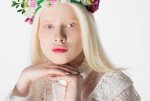 rsz_stock-photo-portrait-pretty-albino-woman-wreath.jpg